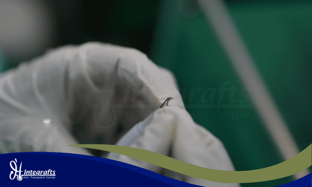 Mengenal Teknik DHI Solusi Transplantasi Rambut, Alis, & Jenggot untuk Hasil Natural