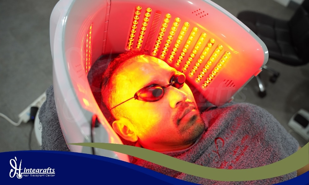 Terapi Laser Tingkat Rendah (LLLT) untuk Rambut Rontok: Apakah Efektif?