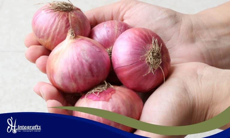 Benarkah Jus Bawang Merah Bisa Hentikan Kebotakan? Ini Kata Penelitian!