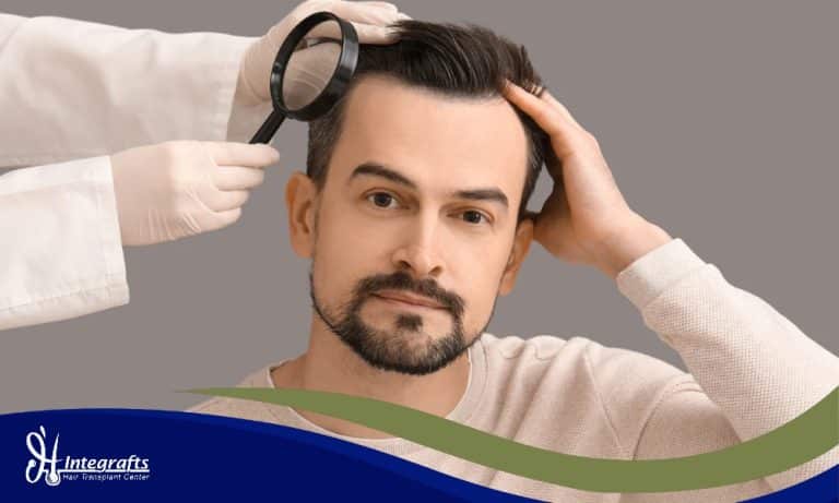 Kepala Bengkak Setelah Transplantasi Rambut? Jangan Panik! Ini Penjelasan Lengkapnya