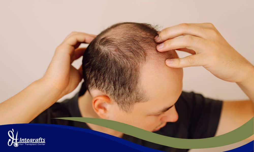 Gatal Luar Biasa di Area Donor dan Resipien Ini Cara Mengatasinya Tanpa Menggaruk