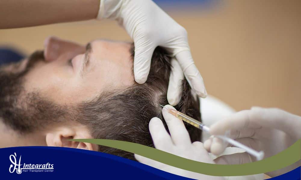 5 Nutrisi & Vitamin Wajib Agar Hasil Hair Transplant Tumbuh Maksimal