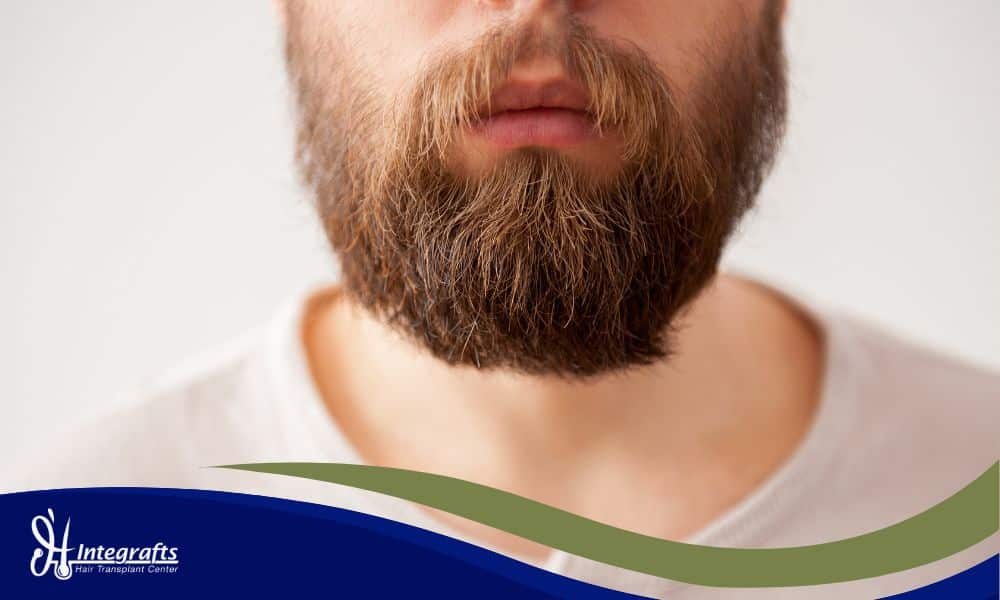 Berapa Graft untuk Transplantasi Jenggot yang Anda Butuhkan agar Tampil Maskulin