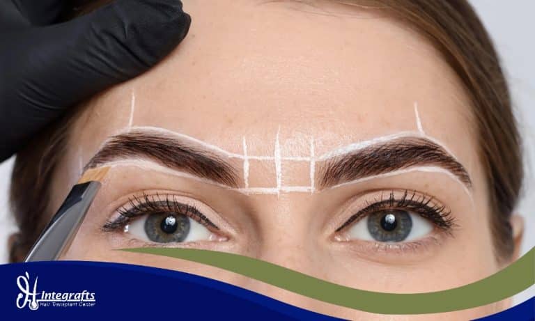 Berapa Biaya Tanam Alis (Eyebrow Transplant) Permanen? Ini Rincian Harga & Faktanya