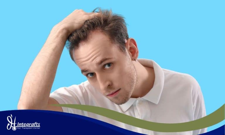 Hairline Hair Transplant, Rahasia Agar Hasil Tidak Terlihat Palsu dan Kaku