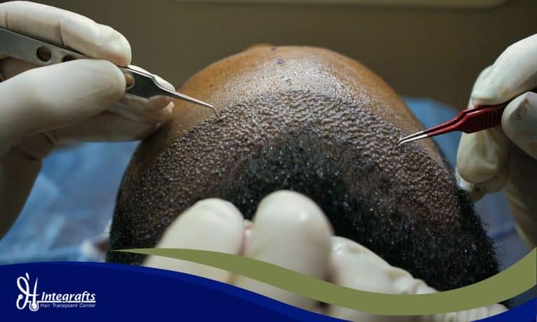 Scabs (Kerak Luka) di Kepala: Bolehkah Dikelupas Paksa?