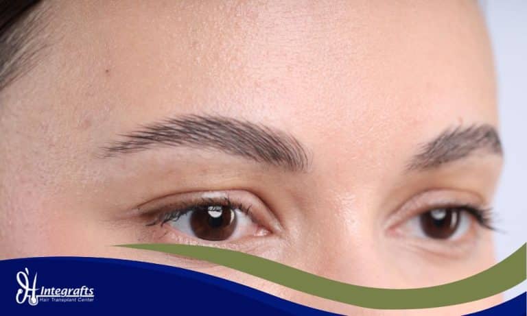 Sulam Alis vs Transplantasi Alis: Mana Solusi Permanen untuk Alis Tebal & Natural?